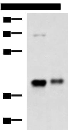 GNAZ Antibody