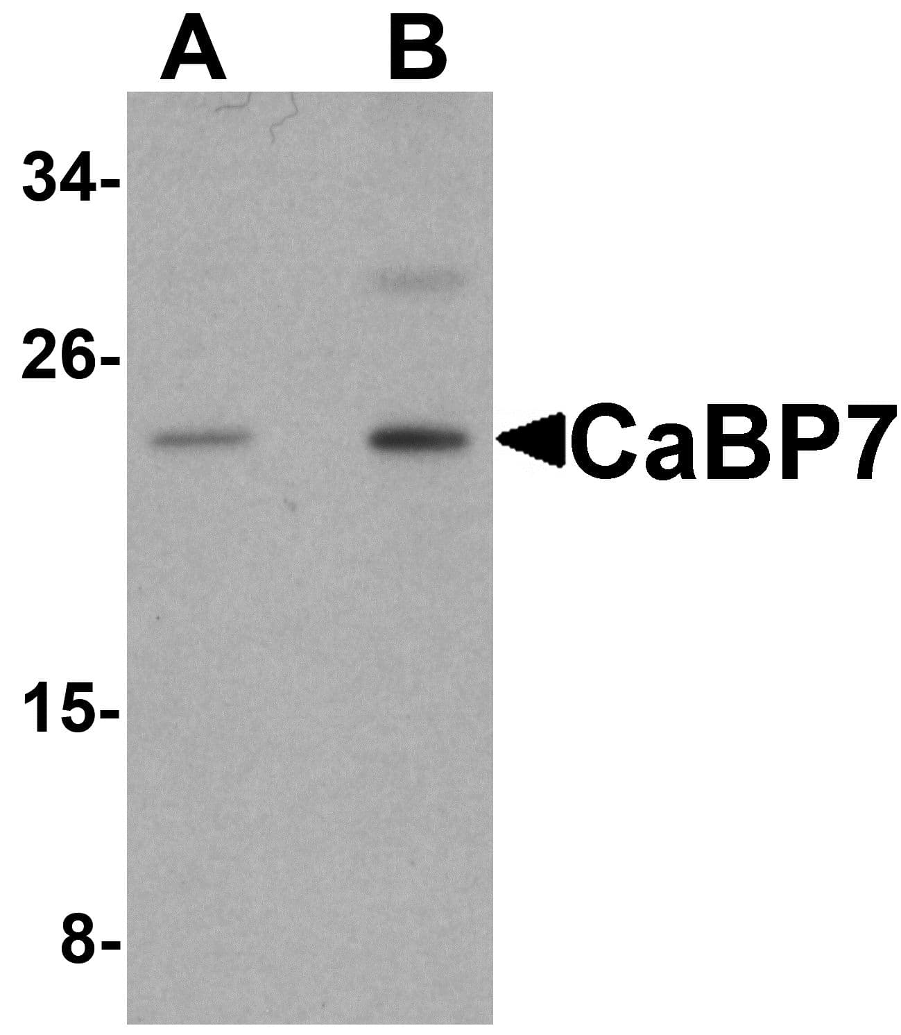 IHC-plus™ Polyclonal Rabbit anti-Human CABP7 Antibody (IHC, IF, WB)