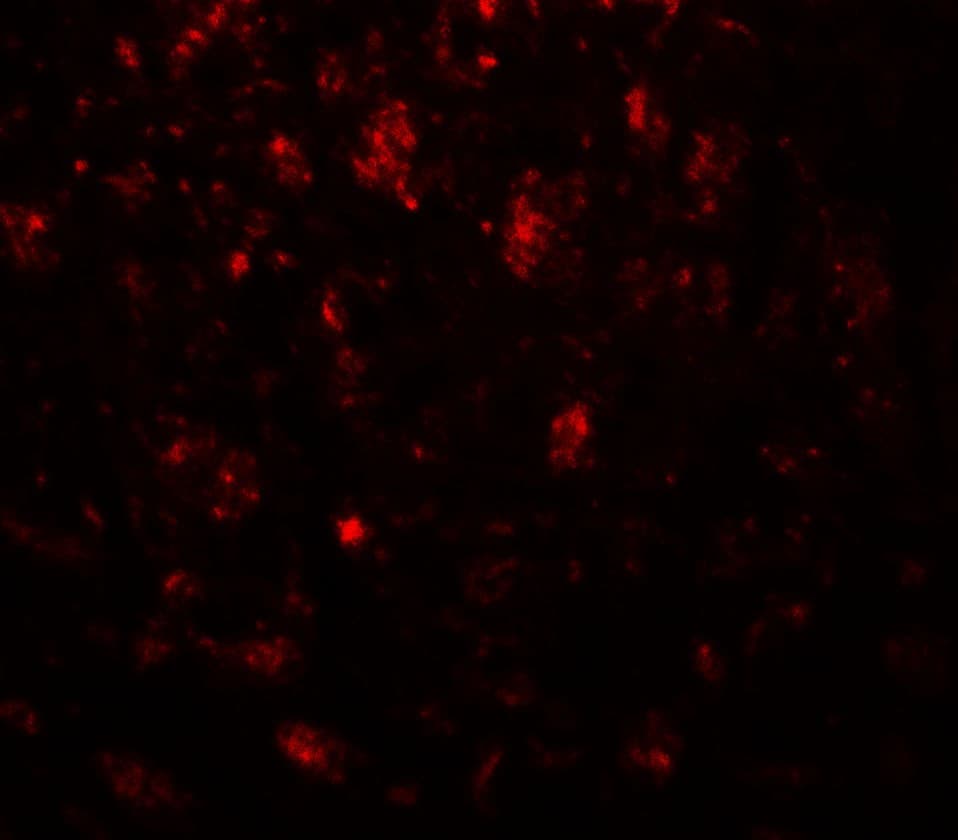 NECL-1 / CADM3 Antibody