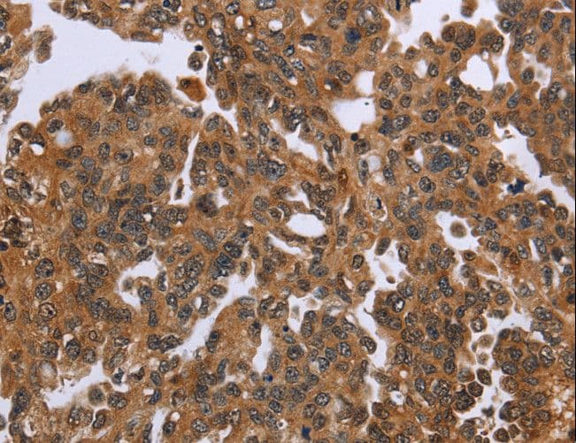 Polyclonal Rabbit anti-Human IHH Antibody (IHC)