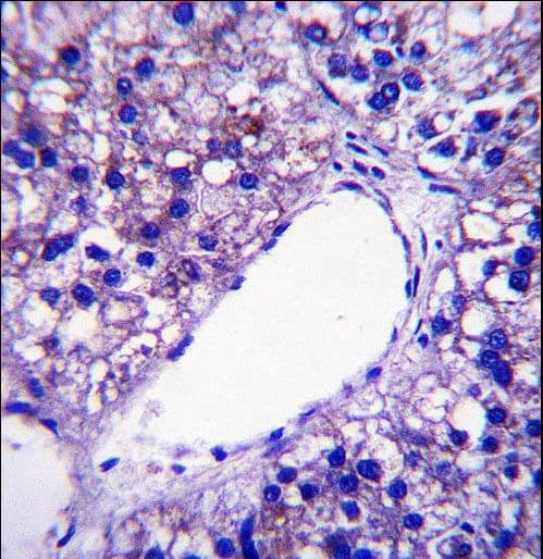 PNPLA4 Antibody (aa171-199)