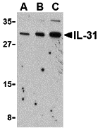 IL31 Antibody