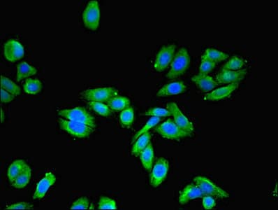 UPK3A / UPK3 / Uroplakin III Antibody