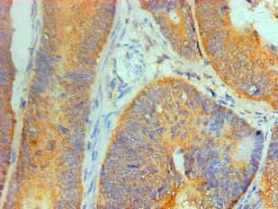 IL1F10 Antibody (clone 2A2B3)