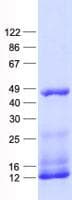 Human OGDH Protein (Recombinant His, N-Terminal)