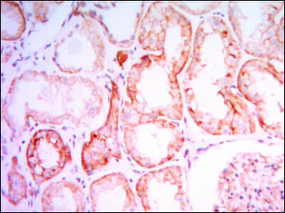 Monoclonal Mouse anti-Human PTHR / PTHR1 Antibody (clone 4D2, IHC, IF, WB)