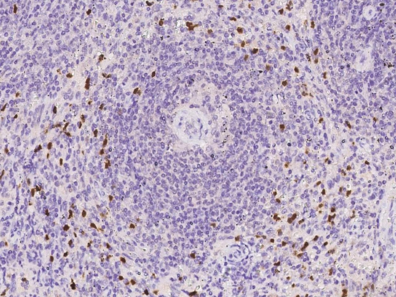 GCL / Grancalcin Antibody