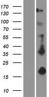 Human EDA / Ectodysplasin A Protein (Over-Expression Lysate Myc-DDK (Flag))