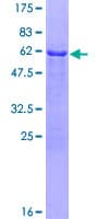 Human TOM1L1 Protein (Recombinant GST)