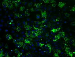 IHC-plus™ ATP5B / ATP Synthase Beta Antibody (clone 5G2)