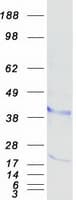 Human CD157 Protein (Recombinant Myc-DDK (Flag))