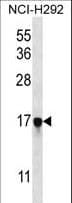 Polyclonal Rabbit anti-Human PAGE5 Antibody (aa102-130, IHC, WB)
