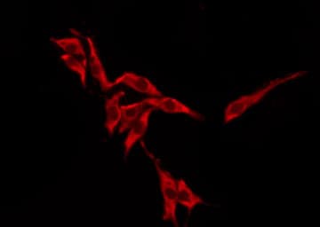 OR10H1 Antibody