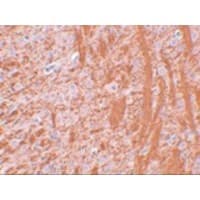 JMJD6 / PSR Antibody
