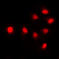 SIN3B Antibody (Internal)
