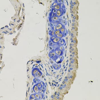Gephyrin Antibody