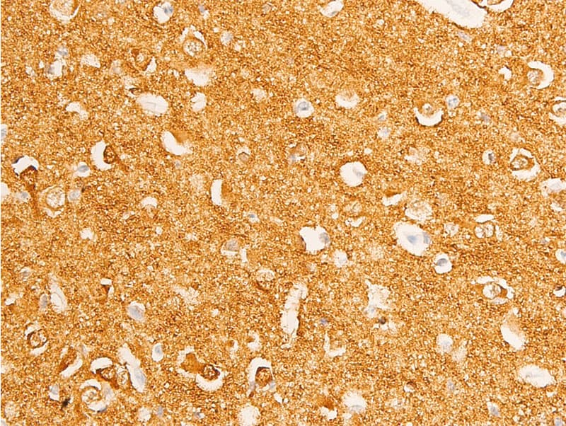 MYC / c-Myc Antibody (phospho-Thr58)