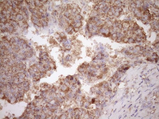 Monoclonal Mouse anti-Human FSCN1 / Fascin Antibody (clone OTI3B4, IHC, WB)