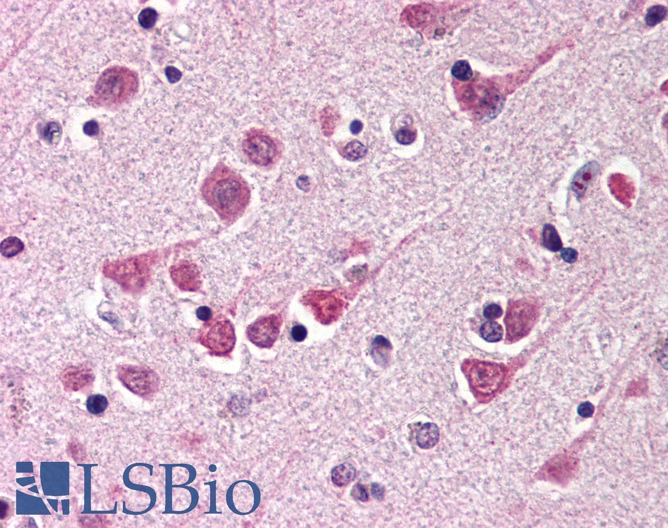 IHC-plus™ MOAP1 / MAP1 Antibody