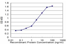 Monoclonal Mouse anti-Human DBN1 / Drebrin Antibody (clone 2E11, WB)