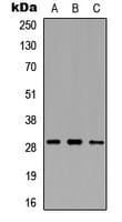 MMP26 Antibody (Internal)