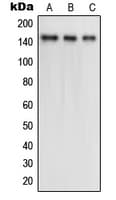 Polyclonal Rabbit anti-Human NTRK2 / TRKB Antibody (phospho-Tyr516, WB)