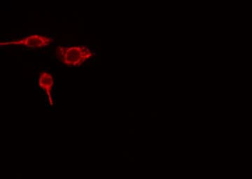 VTI1B Antibody