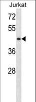 STK33 Antibody (aa39-68)