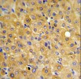 HURP / DLGAP5 Antibody (aa228-258)