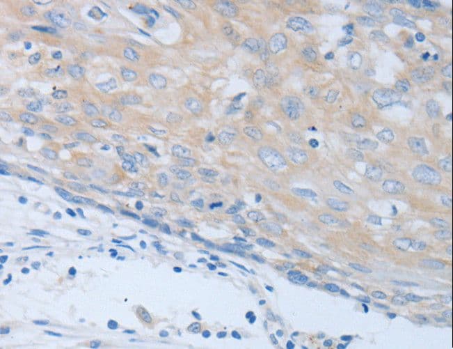 CHRNA7 Antibody