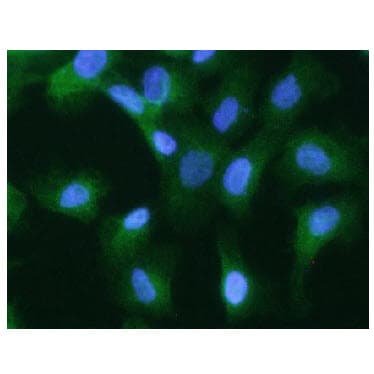 KRT20 / CK20 / Cytokeratin 20 Antibody (clone AT10D8)
