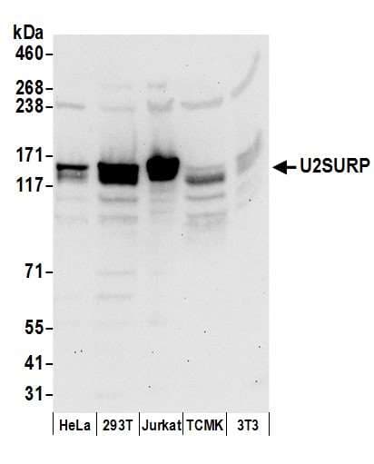 SR140 / U2SURP Antibody (aa1-50)
