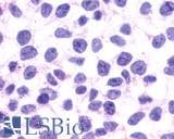 IHC-plus™ CXCR1 Antibody (N-Terminus)