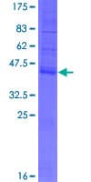 Human TMEM208 Protein (Recombinant GST)