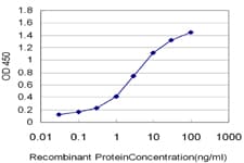 EPHB3 / EPH Receptor B3 Antibody (clone 1E12)