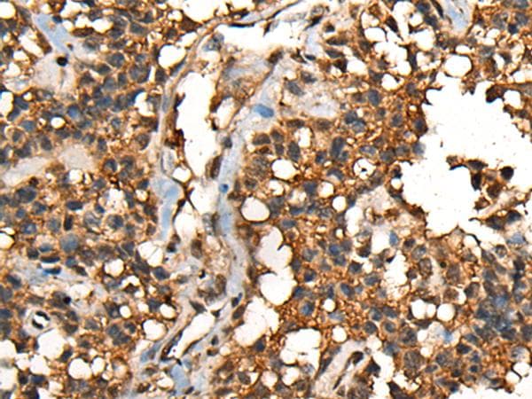 SHPK / CARKL Antibody