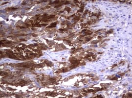 TS / Thymidylate Synthase Antibody (clone OTI5H8, Carrier-free)