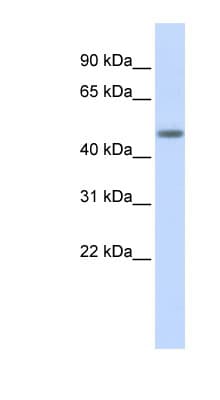 Polyclonal Rabbit anti-Human LASS5 Antibody (aa72-121, WB)