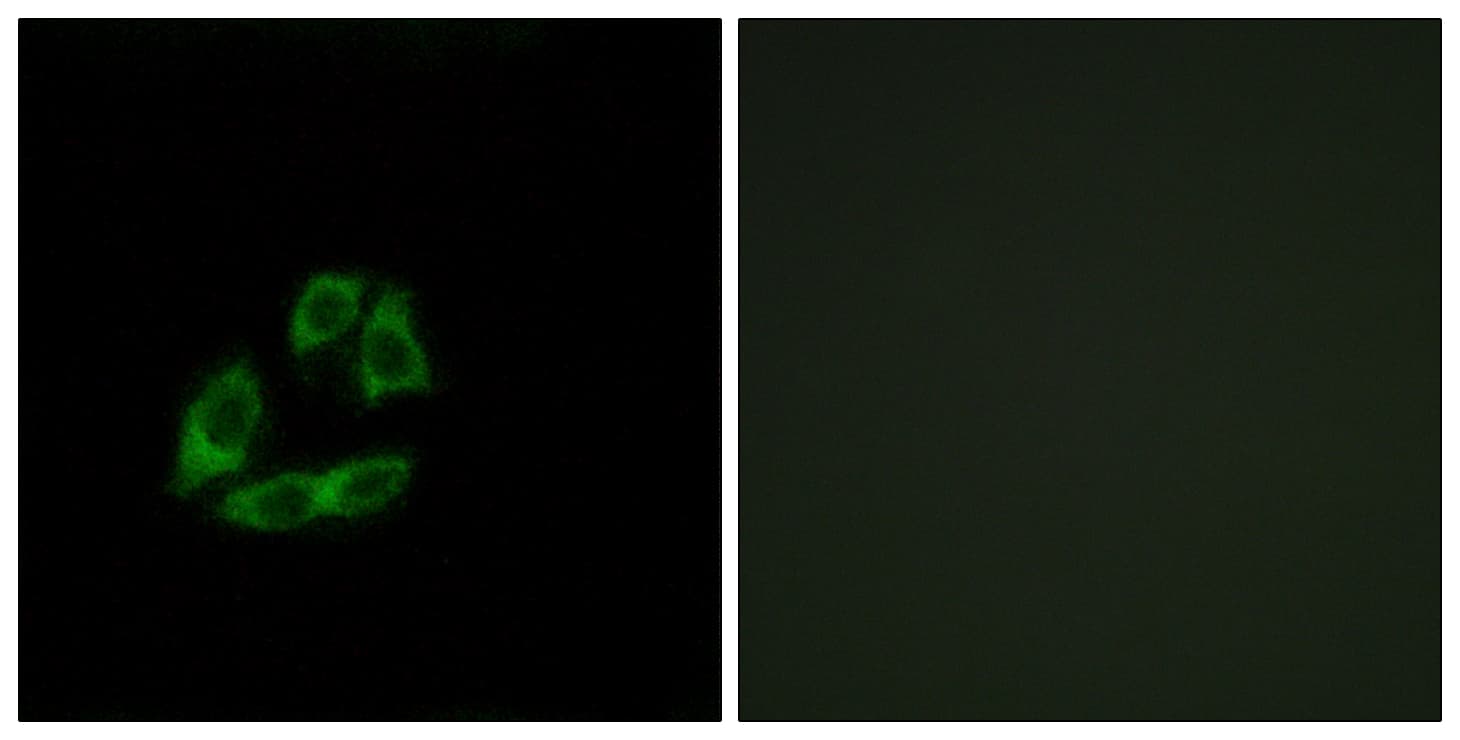 IHC-plus™ Polyclonal Rabbit anti-Human ARFIP1 Antibody (aa271-320, IHC, IF, WB)