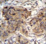 Polyclonal Rabbit anti-Human TTC9C Antibody (aa1-30, IHC, WB)