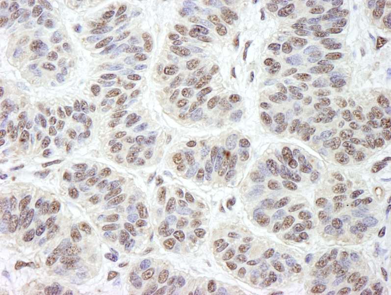 GNL3 / NS / Nucleostemin Antibody (aa500-C-term)
