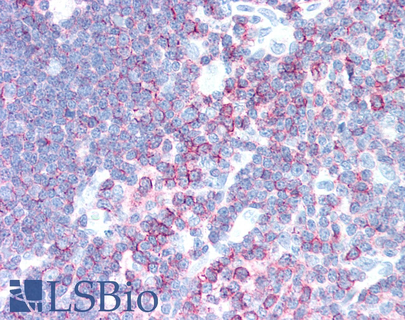 PathPlus™ SPN / CD43 Antibody