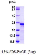 Human MLC2 / MYL9 Protein (Recombinant 6His, N-terminus)