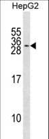 KCNMB2 Antibody (aa1-30)