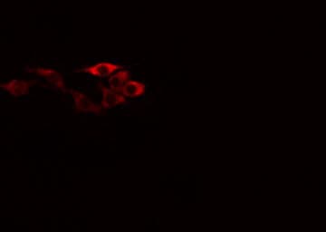 Polyclonal Rabbit anti-Human GK / Glycerol Kinase Antibody (IF, WB)