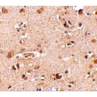 NANOS2 / NOS2 Antibody