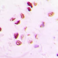 Polyclonal Rabbit anti-Human RAD50 Antibody (Internal, IHC, WB)