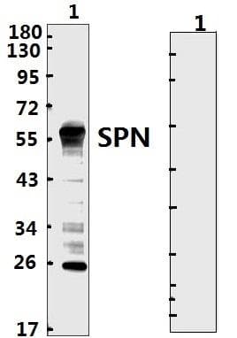 Coronavirus SARS-CoV-2 SARS-CoV-2 Nucleoprotein (Recombinant His,N-terminus)
