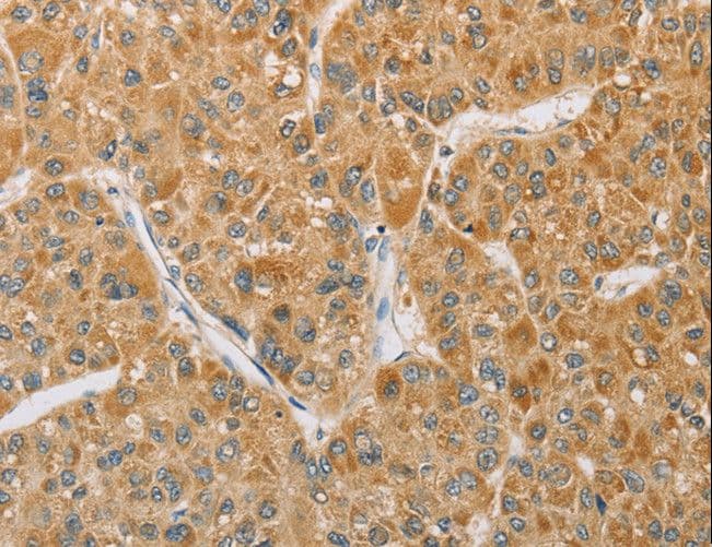 ARHGEF1 Antibody