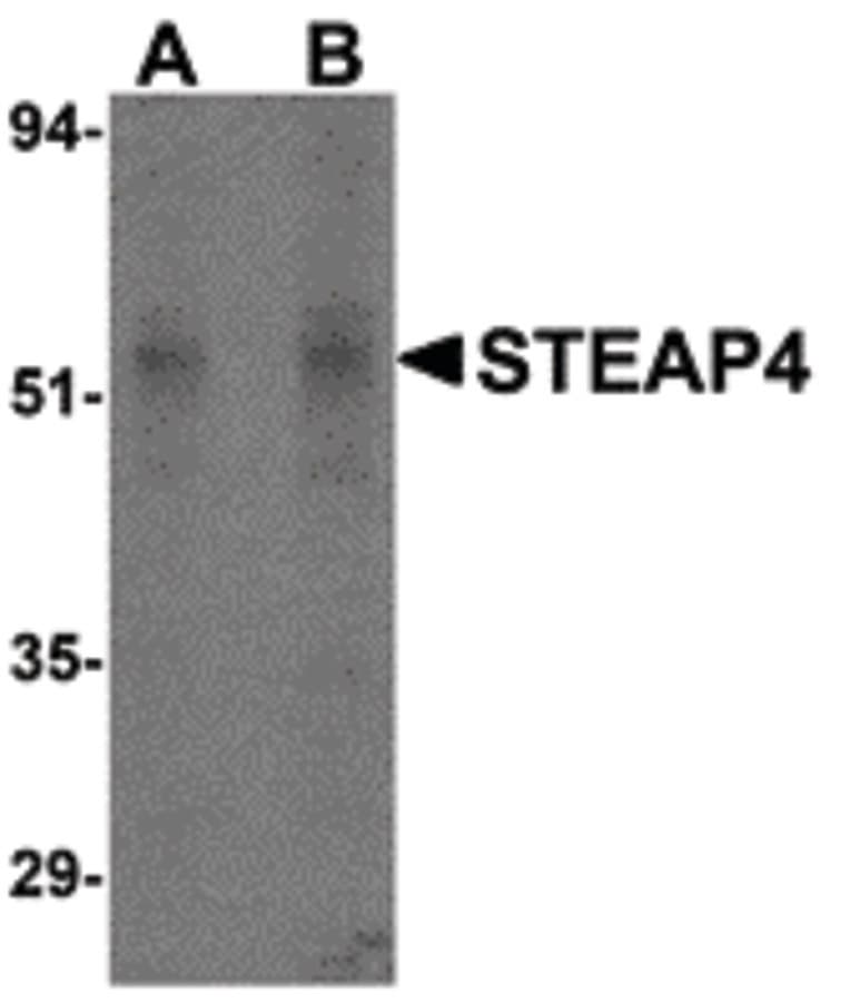 IHC-plus™ STEAP4 Antibody